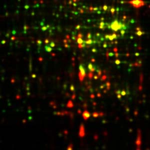 Dual View (overlay) of two gel images Dual View (overlay) of two gel images